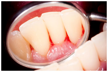 periodoncia2